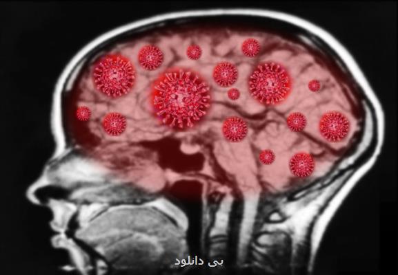 كروناویروس می تواند به مغز صدمه بزند