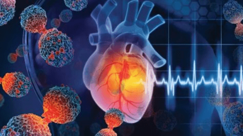 ایران پیشگام کاردیوانکولوژی در خاورمیانه