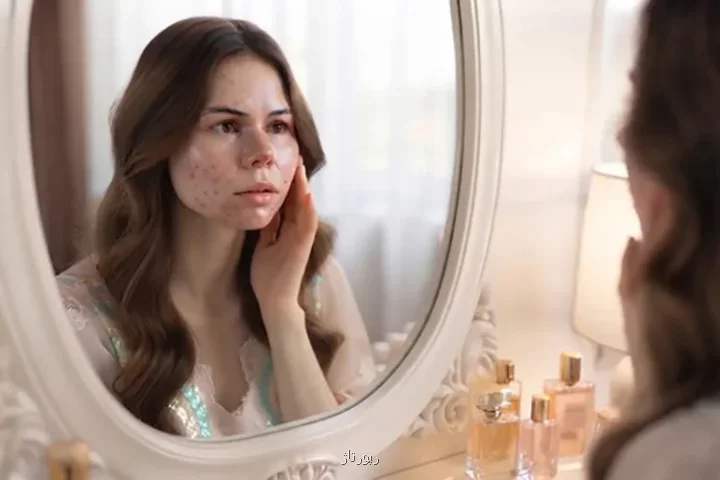 چرا هر کاری می کنم باز هم جوش می زنم؟